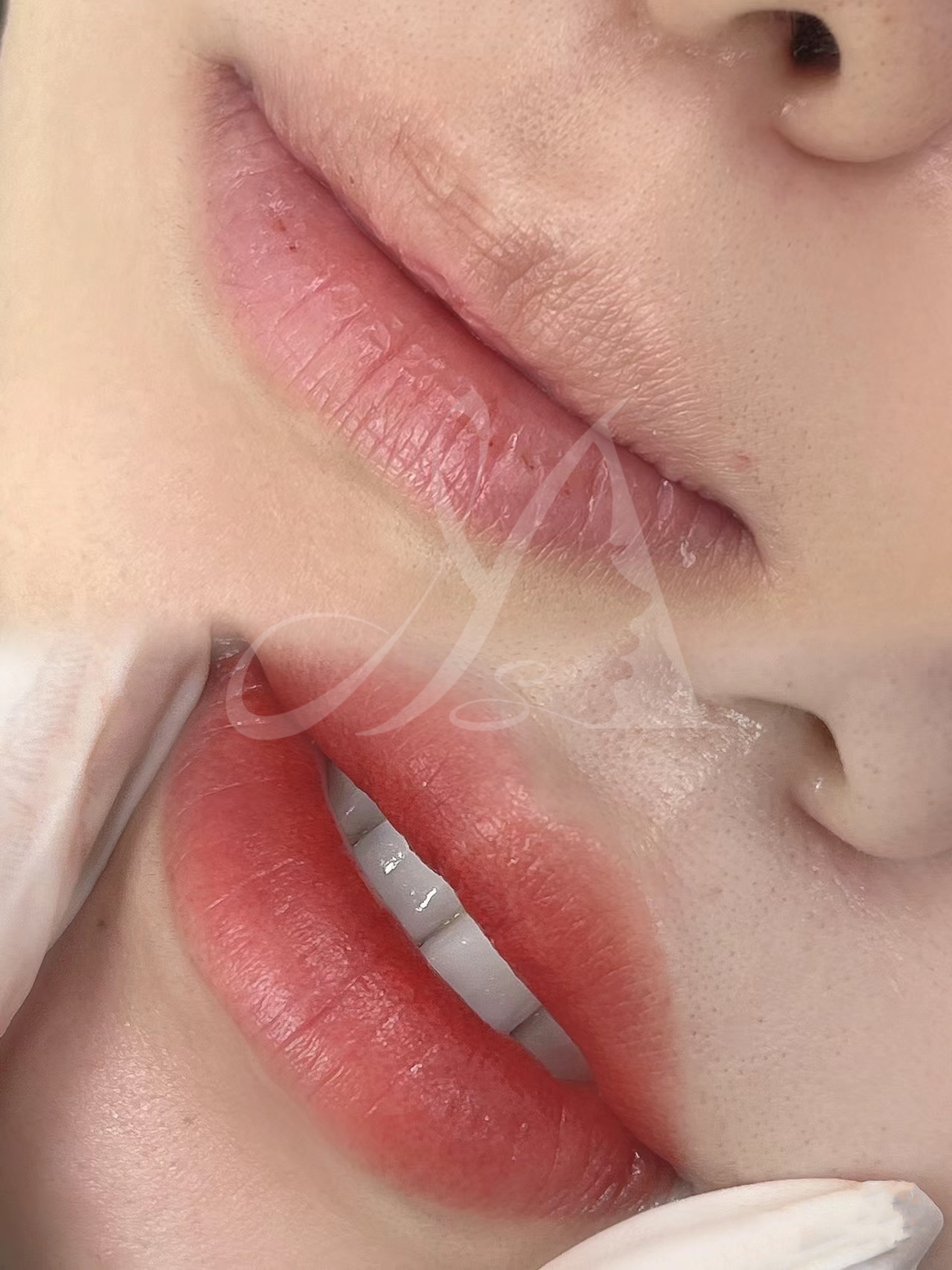Lip