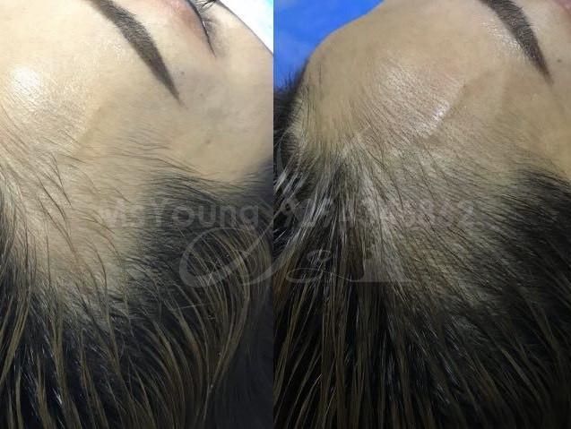 Hair Liner